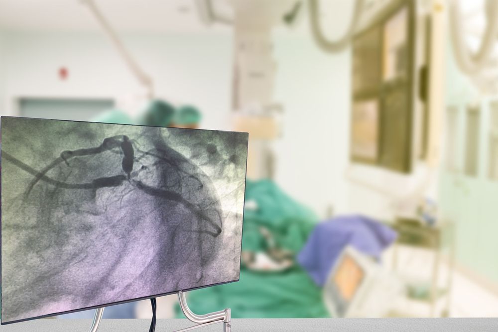 Coronary Angiogram