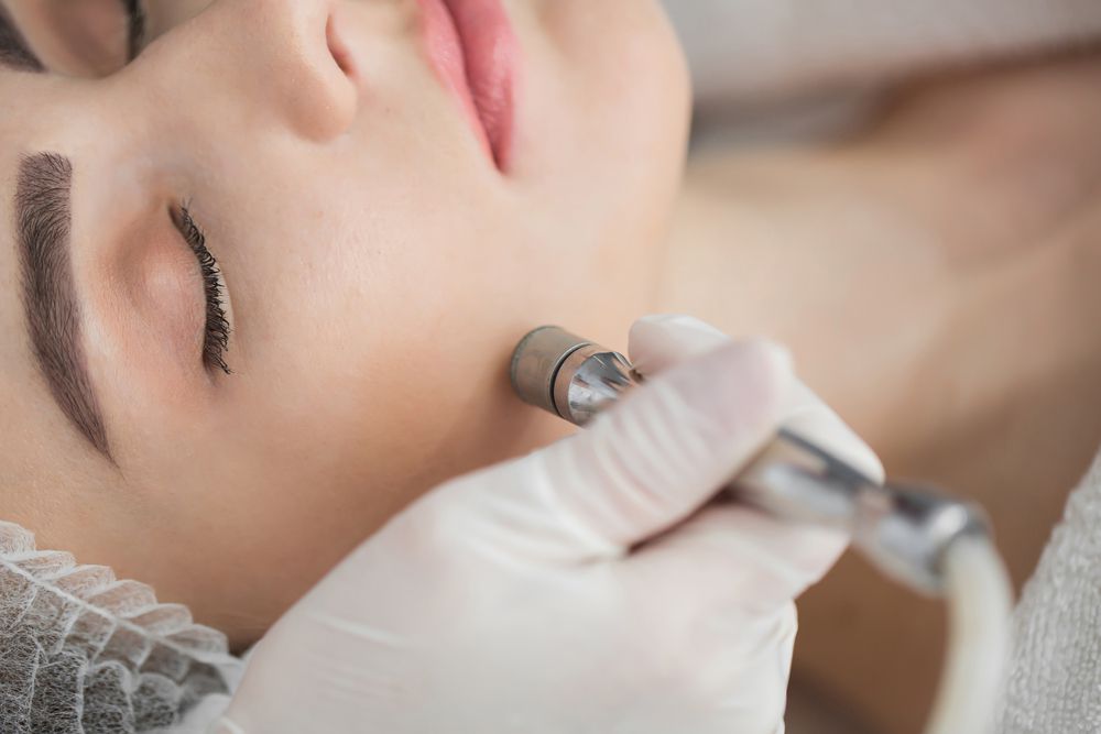 Microdermabrasion