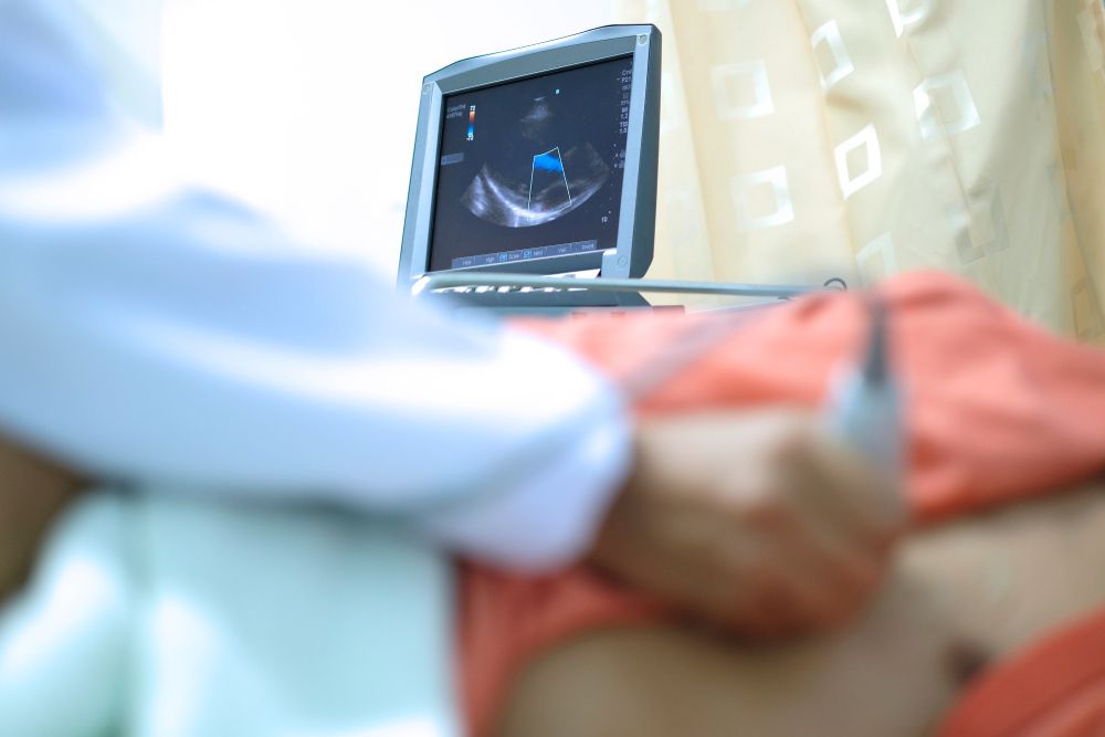 Electrocardiogram