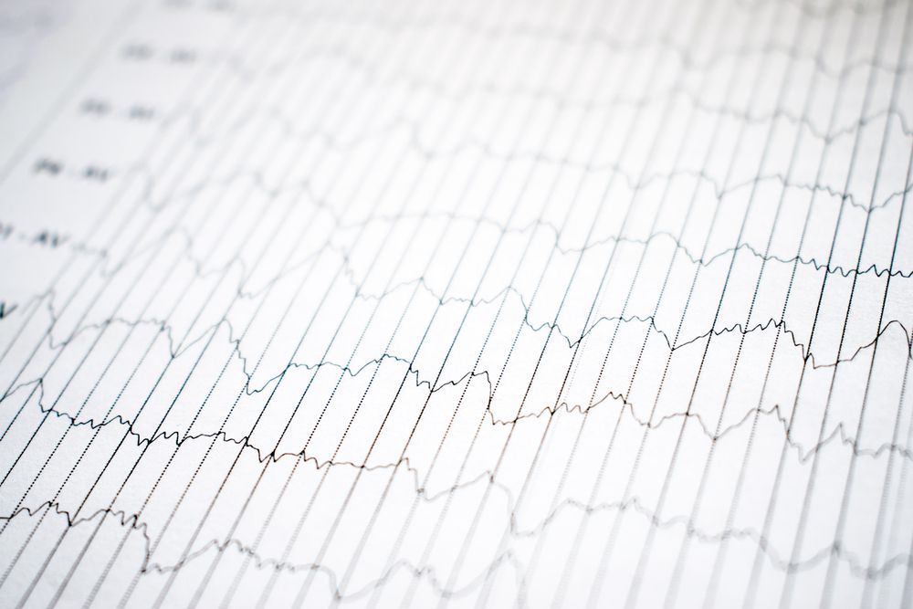 Cardiac Electrophysiology